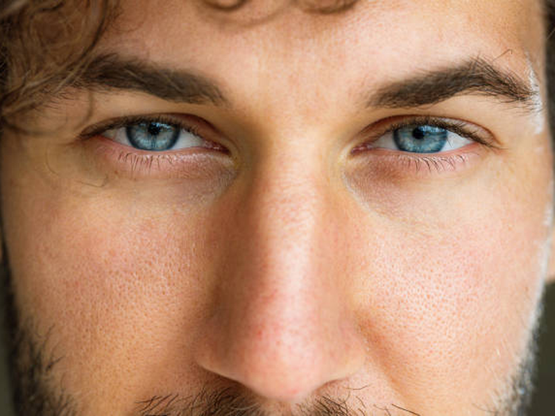 La greffe de sourcils homme